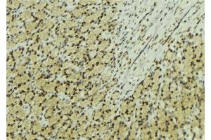 Immunohistochemistry (IHC) image for anti-Nudix (Nucleoside Diphosphate Linked Moiety X)-Type Motif 1 (NUDT1) (Internal Region) antibody (ABIN6263763)
