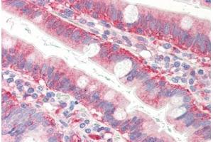 Human Small Intestine (formalin-fixed, paraffin-embedded) stained with CFL1 antibody ABIN364365 at 10 ug/ml followed by biotinylated anti-mouse IgG secondary antibody ABIN481714, alkaline phosphatase-streptavidin and chromogen.