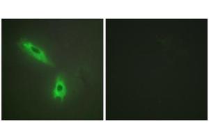 Immunofluorescence analysis of HeLa cells, using TNFC antibody. (LTB Antikörper  (C-Term))
