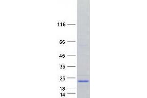 Validation with Western Blot (C2orf52/LINC00471 Protein (Myc-DYKDDDDK Tag))