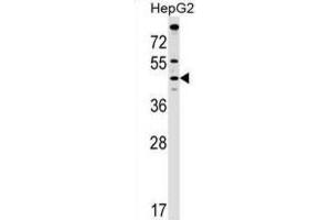 Western Blotting (WB) image for anti-Malonyl CoA:ACP Acyltransferase (Mitochondrial) (MCAT) antibody (ABIN2999330) (MCAT Antikörper)