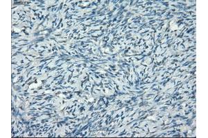 Immunohistochemical staining of paraffin-embedded colon tissue using anti-PPP5Cmouse monoclonal antibody. (PP5 Antikörper)