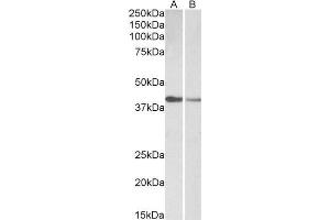 ABIN2613399 (0. (Cardiac Troponin T2 Antikörper  (AA 201-213))