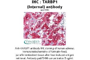 TARBP1 Antikörper  (Internal Region)
