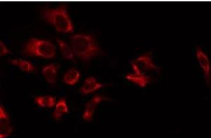 ABIN6277353 staining NIH-3T3 by IF/ICC. (CXCR2 Antikörper  (C-Term))