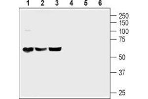 Western blot analysis of mouse brain (lanes 1 and 4), rat brain (lanes 2 and 5) and rat cerebellum (lanes 3 and 6) lysates: - 1-3. (ADCYAP1R1 Antikörper  (C-Term, Intracellular))