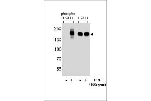 Western blot analysis of extracts from A431 cell, untreated or treated with EGF, using phospho-EGFR-p (left) or ErBB2 antibody (right). (EGFR Antikörper  (pSer1070))