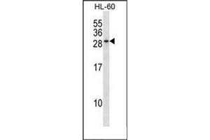 Western blot analysis of RAB15 Antibody (Center) in HL-60 cell line lysates (35ug/lane). (RAB15 Antikörper  (Middle Region))