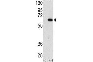 Western blot analysis of AMFR antibody and 293 cell lysate (2 ug/lane) either nontransfected (Lane 1) or transiently transfected with the AMFR gene (2). (AMFR Antikörper  (AA 571-601))