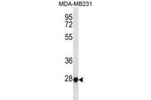 Western Blotting (WB) image for anti-Transcription Factor EC (TFEC) antibody (ABIN3000962) (TFEC Antikörper)