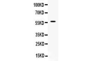 Western blot analysis of APEX2 expression in rat kidney extract ( Lane 1). (APEX2 Antikörper  (AA 102-210))