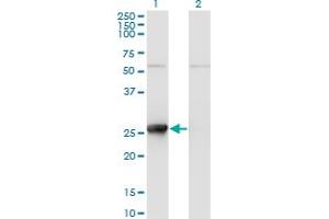 Western Blot analysis of TK1 expression in transfected 293T cell line by TK1 monoclonal antibody (M11), clone 2A2.