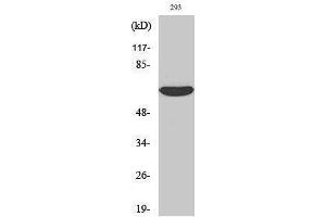 Western Blotting (WB) image for anti-Interleukin-1 Receptor-Associated Kinase 2 (IRAK2) (Internal Region) antibody (ABIN3185223) (IRAK2 Antikörper  (Internal Region))