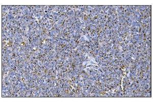 IHC analysis of MERTK using anti-MERTK antibody (ABIN7600623). (MERTK Antikörper  (AA 21-489))