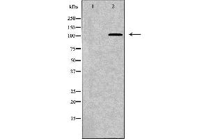 Western blot analysis of K562 whole cell lysates, using TNK2 Antibody. (TNK2 Antikörper  (C-Term))