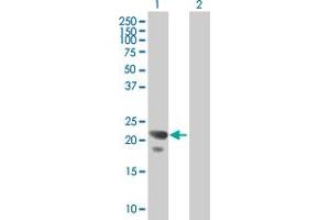 Western Blot analysis of COPS8 expression in transfected 293T cell line by COPS8 MaxPab polyclonal antibody. (COPS8 Antikörper  (AA 1-209))