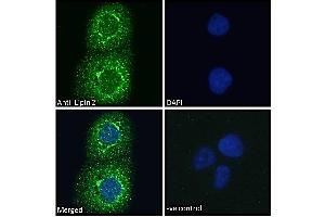 ABIN185361 Immunofluorescence analysis of paraformaldehyde fixed A431 cells, permeabilized with 0. (Lipin 2 Antikörper  (C-Term))