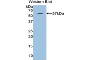 Western blot analysis of the recombinant protein. (ALDH7A1 Antikörper  (AA 28-539))