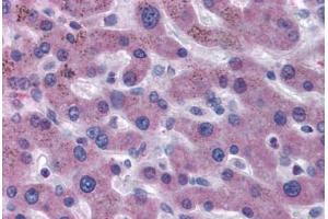Human Liver (formalin-fixed, paraffin-embedded) stained with F7 antibody ABIN481753 at 5 ug/ml followed by biotinylated secondary antibody, alkaline phosphatase-streptavidin and chromogen.