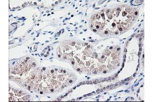 Immunohistochemical staining of paraffin-embedded Human Kidney tissue using anti-NUBPL mouse monoclonal antibody. (NUBPL Antikörper  (AA 1-250))