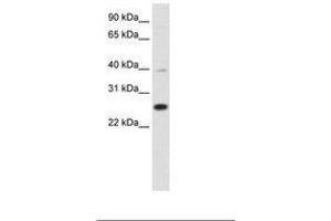 Image no. 1 for anti-YY1 Associated Factor 2 (YAF2) (C-Term) antibody (ABIN6736123) (YAF2 Antikörper  (C-Term))