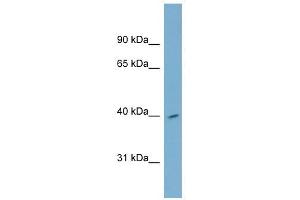 H2AFY2 antibody used at 1 ug/ml to detect target protein.