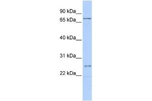 WB Suggested Anti-GALNT14 Antibody Titration:  0. (GALNT14 Antikörper  (Middle Region))