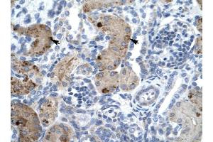 ZNF258 antibody was used for immunohistochemistry at a concentration of 4-8 ug/ml to stain Epithelial cells of renal tubule (arrows) in Human Kidney. (ZMYM6 Antikörper  (Middle Region))