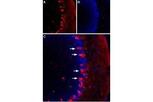 Expression of HCN1 in rat cerebellumImmunohistochemical staining of rat cerebellum using Guinea pig Anti-HCN1 Antibody (ABIN7043277, ABIN7045448 and ABIN7045449). (Hyperpolarization Activated Cyclic Nucleotide-Gated Potassium Channel 1 (HCN1) Peptid)