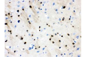 nti- Stathmin 1 Picoband antibody, IHC(P) IHC(P): Rat Brain Tissue (Stathmin 1 Antikörper  (N-Term))