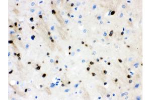 nti- Stathmin 1 Picoband antibody, IHC(P) IHC(P): Rat Brain Tissue