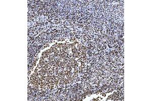 IHC analysis of HMGN2 using anti-HMGN2 antibody (ABIN6719576).