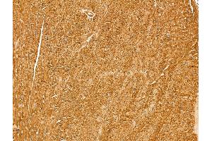 Myoferlin Antibody at 1/100 staining Mouse heart tissue by IHC-P. (Myoferlin Antikörper  (Internal Region))