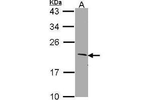 WB Image Sample (30 ug of whole cell lysate) A: Molt-4 , 12% SDS PAGE SERTAD1 antibody antibody diluted at 1:1000