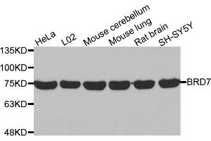 Western Blotting (WB) image for anti-Bromodomain Containing 7 (BRD7) antibody (ABIN1871354) (BRD7 Antikörper)