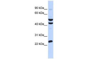 Western Blot showing ZNF200 antibody used at a concentration of 1-2 ug/ml to detect its target protein. (ZNF200 Antikörper  (Middle Region))