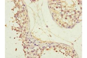 Immunohistochemistry of paraffin-embedded human testis tissue using ABIN7147423 at dilution of 1:100 (CEP72 Antikörper  (AA 200-460))