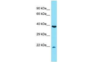 Host: Rabbit Target Name: C7orf50 Sample Type: RPMI-8226 Whole Cell lysates Antibody Dilution: 1. (C7orf50 Antikörper  (N-Term))