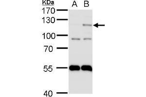 WB Image HIF2 alpha antibody detects HIF2 alpha protein by western blot analysis. (EPAS1 Antikörper)