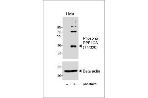 Western blot analysis of lysates from Hela cell line, untreated or treated with paclitaxel, 100nM, 20hrs, using Phospho-P1CA (Thr320) Antibody (uer) or Beta-actin (lower). (PPP1CA Antikörper  (pThr320))