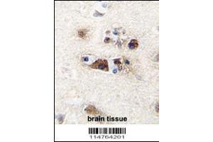 Immunohistochemistry (IHC) image for anti-Leucine-Rich Repeat Containing G Protein-Coupled Receptor 5 (LGR5) (AA 238-270), (N-Term) antibody (ABIN5536143)