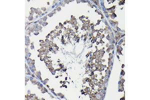 Immunohistochemistry of paraffin-embedded mouse liver using Ferritin Heavy Chain Rabbit pAb (ABIN3021538, ABIN3021539, ABIN3021540 and ABIN6215218) at dilution of 1:100 (40x lens). (FTH1 Antikörper  (AA 1-183))