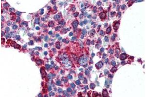 Human Bone Marrow (formalin-fixed, paraffin-embedded) stained with CYCS antibody ABIN305748 at 5 ug/ml followed by biotinylated anti-mouse IgG secondary antibody ABIN481714, alkaline phosphatase-streptavidin and chromogen. (Cytochrome C Antikörper  (AA 1-80))