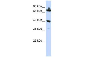 WB Suggested Anti-C7orf31 Antibody Titration: 0. (C7orf31 Antikörper  (N-Term))