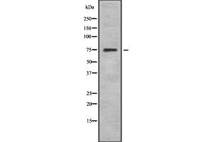 Western blot analysis SphK2 using 293 whole cell lysates (SPHK2 Antikörper  (N-Term))