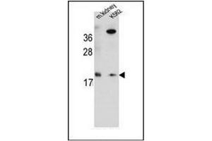 Western blot analysis of RNF185 Antibody  in Mouse kidney tissue and K562 cell line lysates (35ug/lane).