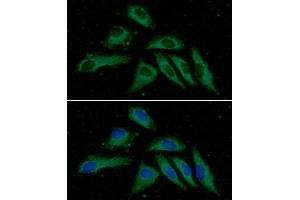 ICC/IF analysis of PPM1F in HeLa cells line, stained with DAPI (Blue) for nucleus staining and monoclonal anti-human PPM1F antibody (1:100) with goat anti-mouse IgG-Alexa fluor 488 conjugate (Green). (PPM1F Antikörper  (AA 1-454))