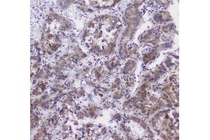 IHC analysis of CFP using anti-CFP antibody (ABIN6719298). (CFP Antikörper)