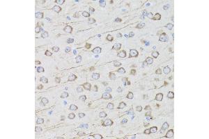 Immunohistochemistry of paraffin-embedded mouse brain using MIP antibody at dilution of 1:100 (x40 lens). (MIP Antikörper)