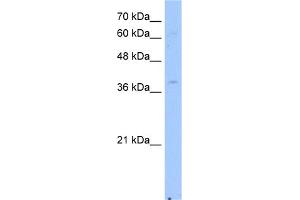 WB Suggested Anti-NSDHL Antibody Titration:  2. (NSDHL Antikörper  (Middle Region))
